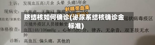 脐结核如何确诊(泌尿系结核确诊金标准)