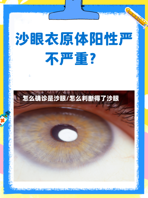 怎么确诊是沙眼/怎么判断得了沙眼-第2张图片