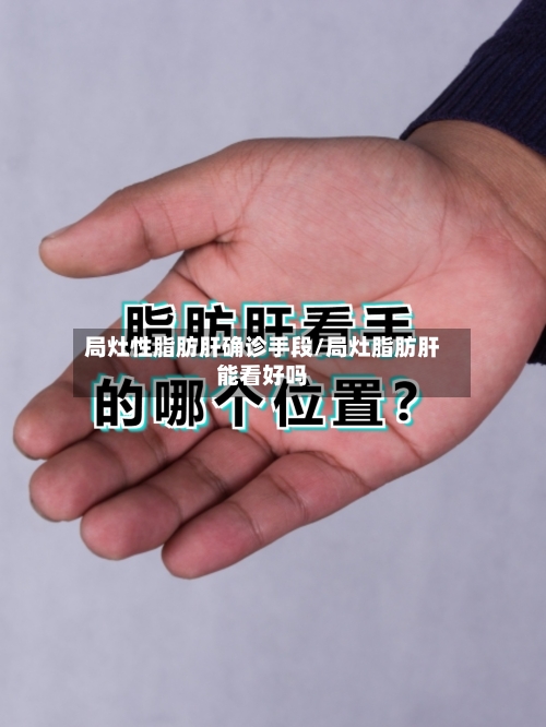 局灶性脂肪肝确诊手段/局灶脂肪肝能看好吗-第1张图片