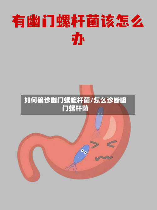 如何确诊幽门螺旋杆菌/怎么诊断幽门螺杆菌-第3张图片