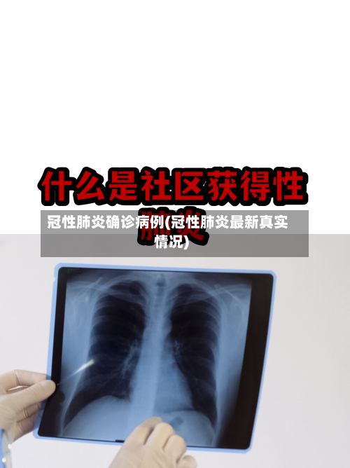 冠性肺炎确诊病例(冠性肺炎最新真实情况)