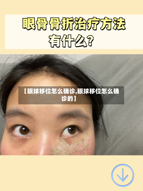 【眼球移位怎么确诊,眼球移位怎么确诊的】-第2张图片